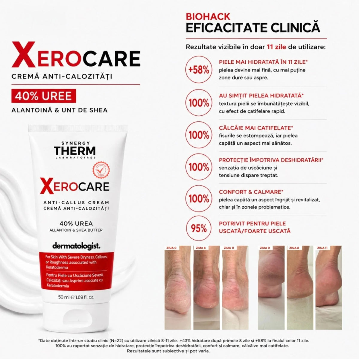 Xerocare Cremă Anti-Calozitǎți Cu 40% Uree, Alantoină Și Unt De Shea – 50ml