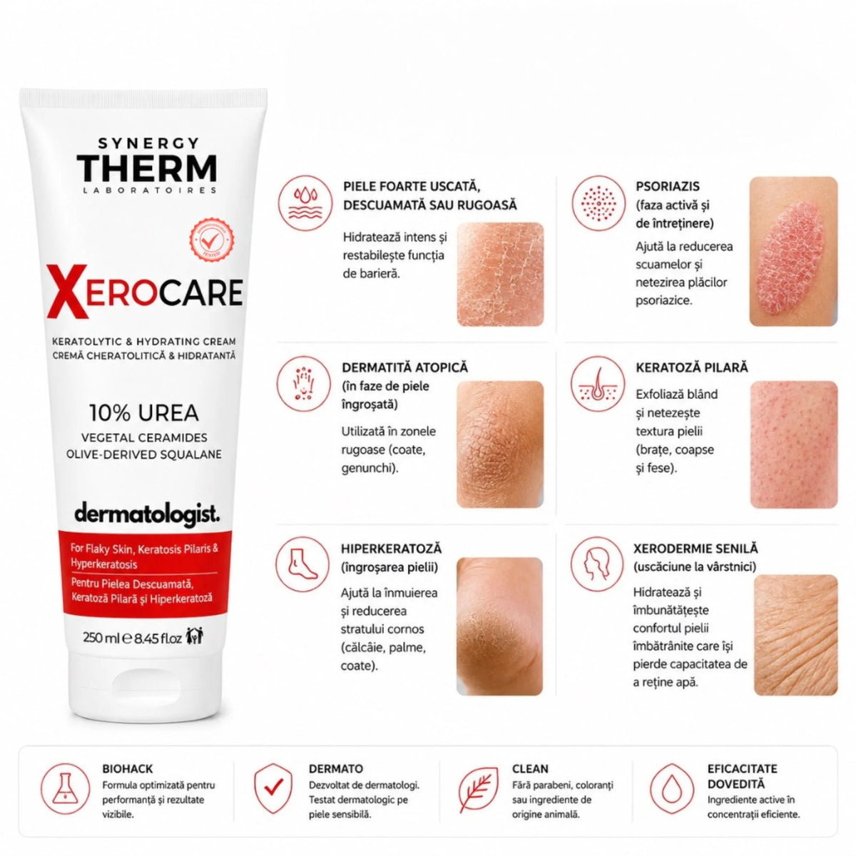 Xerocare Cremă Hidratantă Și Ușor Keratolitică Cu 10% Uree, Ceramide Vegetale Și Squalan Din Măsline – 250ml
