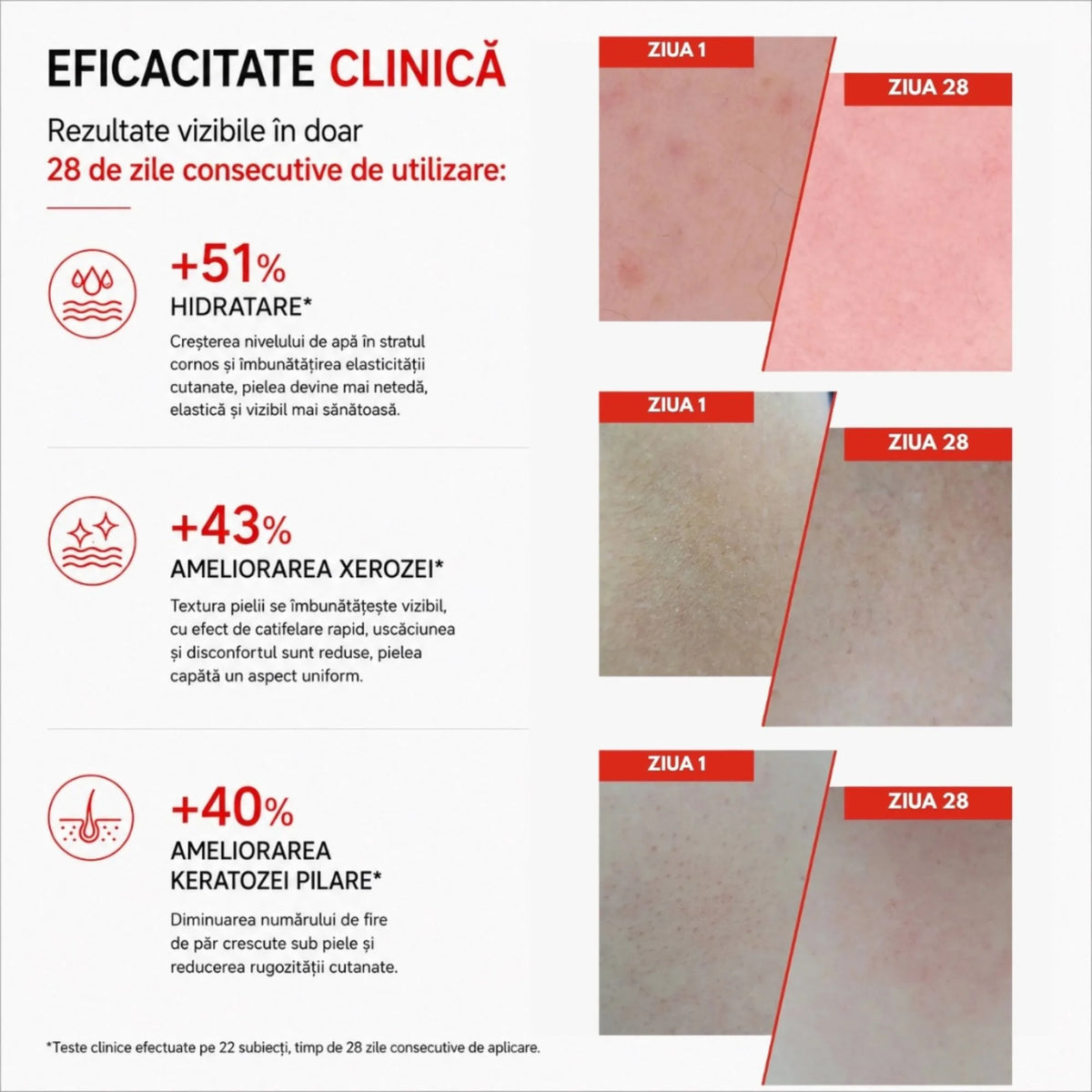 Xerocare Cremă Hidratantă Și Ușor Keratolitică Cu 10% Uree, Ceramide Vegetale Și Squalan Din Măsline – 250ml